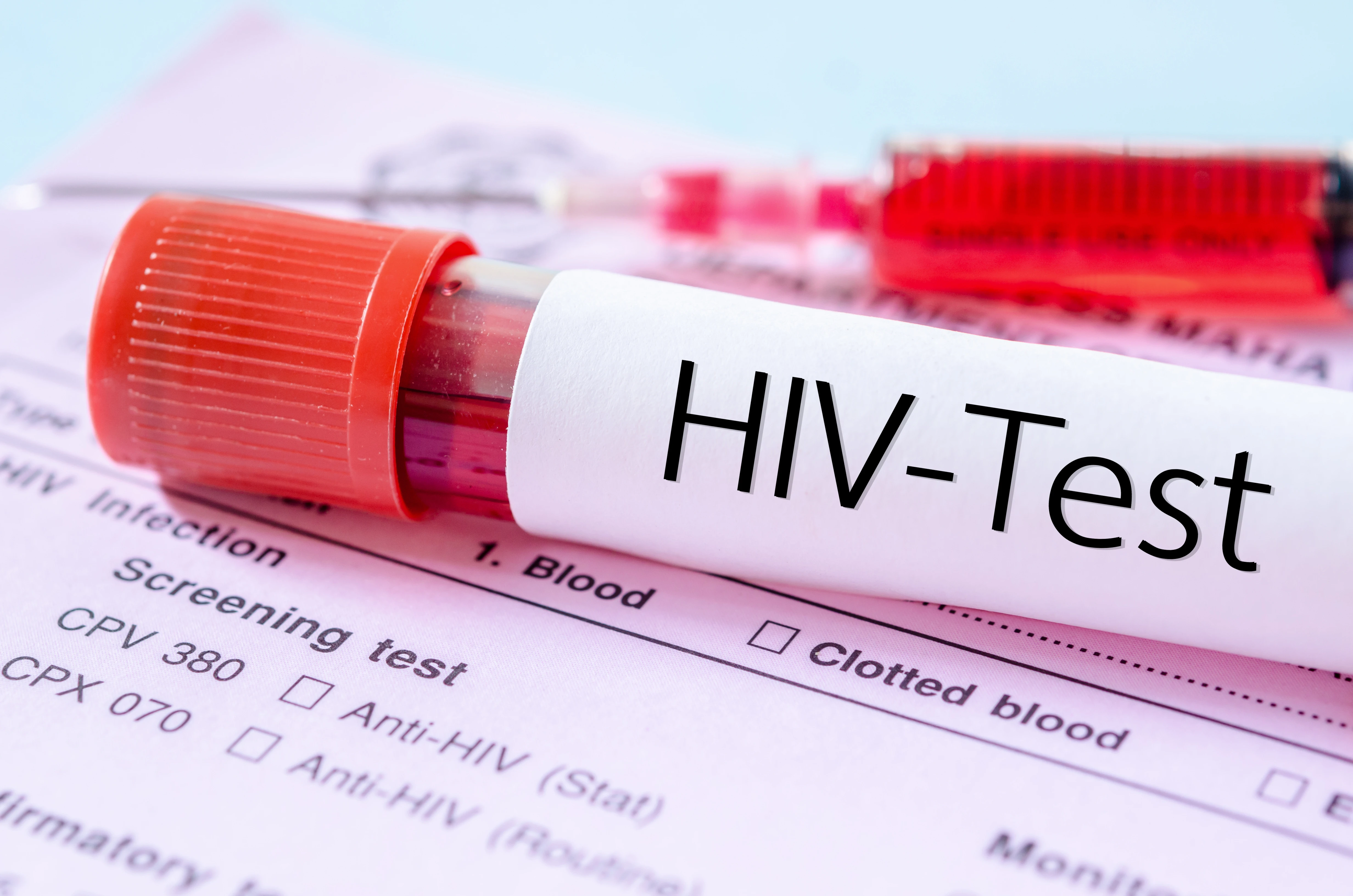 راهنمای جامع HIV و ایدز