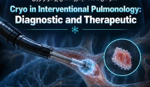 cryo interventional pulmonology Diagnostic and Therapeutic