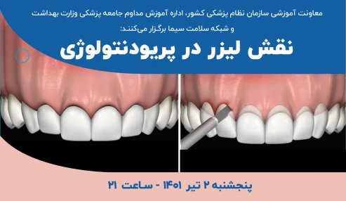 نقش لیزر در پریودنتولوژی