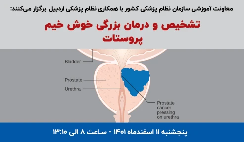 تشخیص و درمان بزرگی خوش خیم پروستات