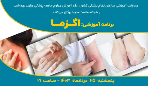 اگزما