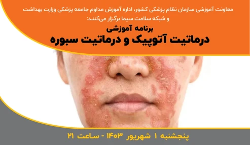 درماتیت آتوپیک و درماتیت سبوره