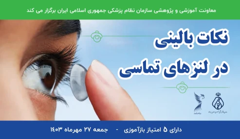 نکات بالینی در لنزهای تماسی