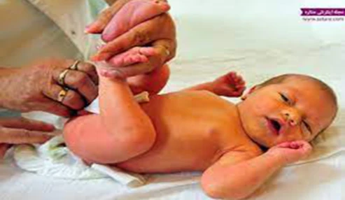 وبینار علمی رتینوپاتی نوزادان نارس