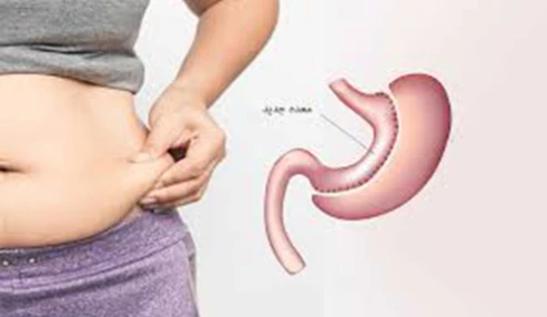 وبینار علمی وبینار علمی وبینار علمی جلسات هفتگی جراحی چاقی و متابولیک