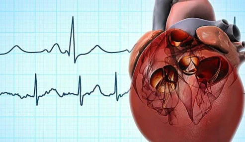 وبینار علمی آشنایی با اختلالات ریتم قلب در دهلیز