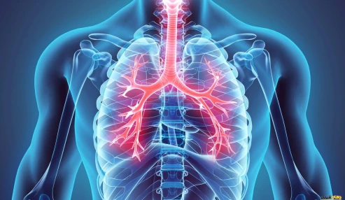 وبینار علمی Vasculitis and eosionophilic pneumonia
