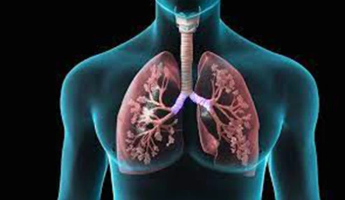 وبینار علمی Malignant pleural effusion
