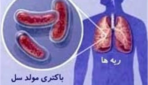 وبینار علمی سل، درمان ها و عوارض دارو یی