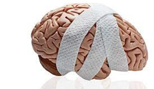 وبینار علمی توانبخشی ضایعات تروماتیک مغزی در کودکان