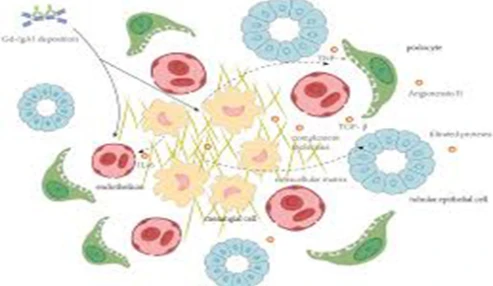 وبینار علمی Mesangial Cell Therapy