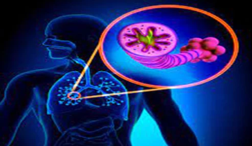 وبینارعملی تازه های copd
