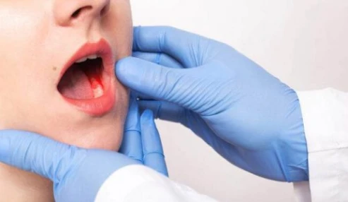 آشنایی با ضایعات شایع پوستی - مخاطی