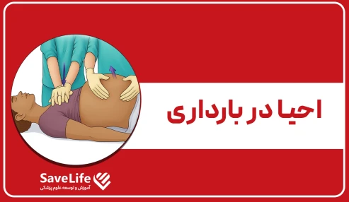 احیا در بارداری