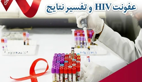 تشخيص آزمايشگاهي عفونت HIV و تفسير نتايج