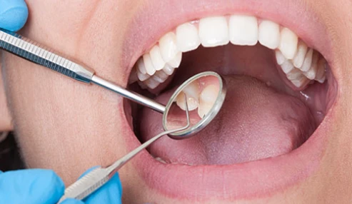 وبینارعلمی ضایعات وزیکولوبولوز و اولسراتیو در حفره دهان