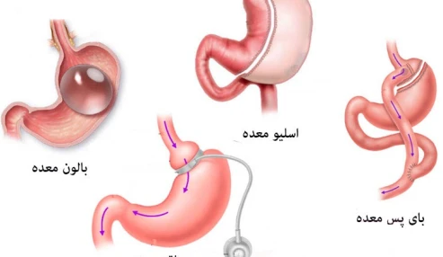 وبینار علمی جلسه جراحان چاقی و متابولیک