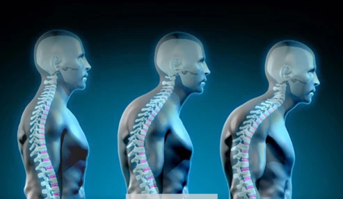 وبینار علمی مدیریت ناهنجاری های اسکلتی